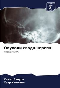Produktbild: Opuholi swoda cherepa