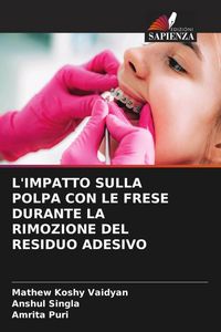 Produktbild: L'impatto Sulla Polpa Con Le Frese Durante La Rimozione Del Residuo Adesivo