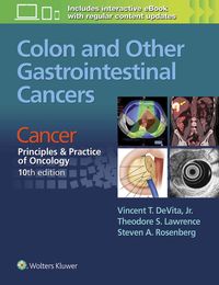 Produktbild: Colon and Other Gastrointestinal Cancers