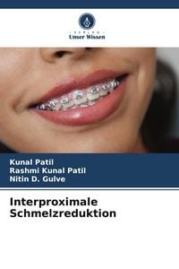 Produktbild: Interproximale Schmelzreduktion