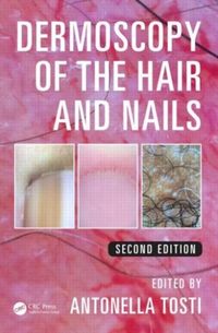 Produktbild: Dermoscopy of the Hair and Nails