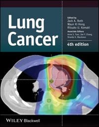 Produktbild: Lung Cancer