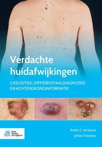 Produktbild: Verdachte huidafwijkingen