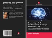 Produktbild: Segmentação do Tumor Cerebral usando Tecnologia de Impressão 3D