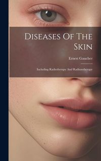 Produktbild: Diseases Of The Skin: Including Radiotherapy And Radiumtherapy