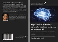 Produktbild: Segmentaci&oacute;n de tumores cerebrales mediante tecnolog&iacute;a de impresi&oacute;n 3D