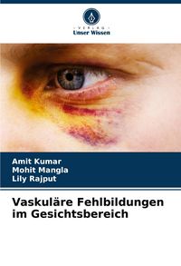 Produktbild: Vaskul&auml;re Fehlbildungen im Gesichtsbereich