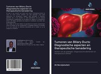 Produktbild: Tumoren van Biliary Ducts: Diagnostische aspecten en therapeutische benadering