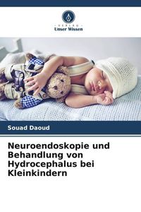 Produktbild: Neuroendoskopie und Behandlung von Hydrocephalus bei Kleinkindern