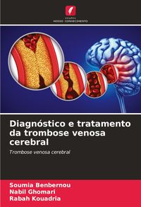 Produktbild: Diagn&oacute;stico e tratamento da trombose venosa cerebral