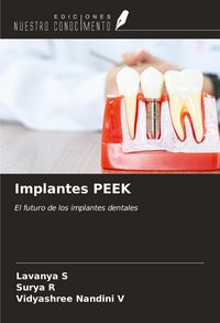 Produktbild: Implantes PEEK
