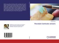 Produktbild: Porcelain laminate veneers