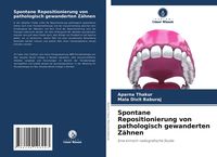 Produktbild: Spontane Repositionierung von pathologisch gewanderten Z&auml;hnen