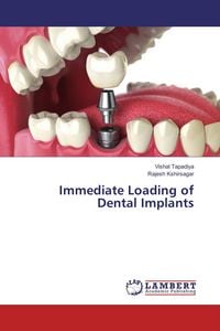 Produktbild: Immediate Loading of Dental Implants