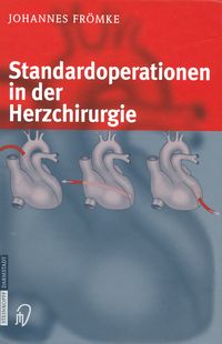Produktbild: Standardoperationen in der Herzchirurgie