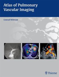 Produktbild: Atlas of Pulmonary Vascular Imaging
