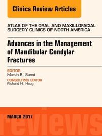 Produktbild: Advances in the Management of Mandibular Condylar Fractures, an Issue of Atlas of the Oral & Maxillofacial Surgery Clinics
