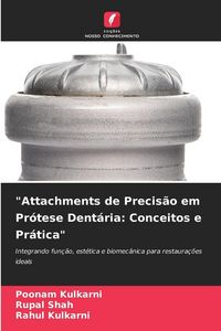 Produktbild: "Attachments de Precis&atilde;o em Pr&oacute;tese Dent&aacute;ria: Conceitos e Pr&aacute;tica"