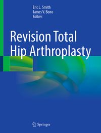 Produktbild: Revision Total Hip Arthroplasty