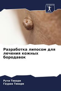 Produktbild: Razrabotka liposom dlq lecheniq kozhnyh borodawok
