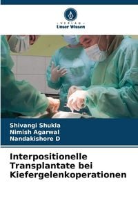 Produktbild: Interpositionelle Transplantate bei Kiefergelenkoperationen