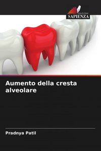 Produktbild: Aumento della cresta alveolare
