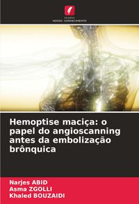 Produktbild: Hemoptise maci&ccedil;a: o papel do angioscanning antes da emboliza&ccedil;&atilde;o br&ocirc;nquica