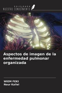 Produktbild: Aspectos de imagen de la enfermedad pulmonar organizada