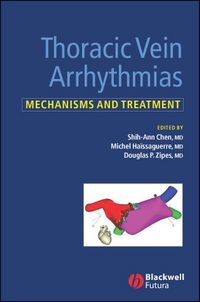 Produktbild: Thoracic Vein Arrhythmias