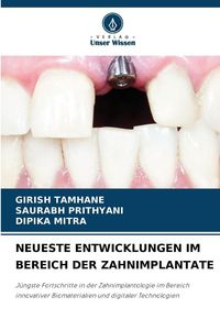 Produktbild: Neueste Entwicklungen im Bereich der Zahnimplantate