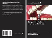Produktbild: Carga inmediata de implantes dentales