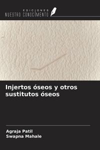 Produktbild: Injertos &oacute;seos y otros sustitutos &oacute;seos