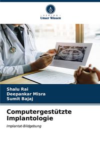 Produktbild: Computergest&uuml;tzte Implantologie