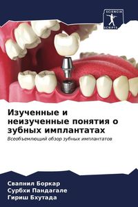 Produktbild: Izuchennye i neizuchennye ponqtiq o zubnyh implantatah