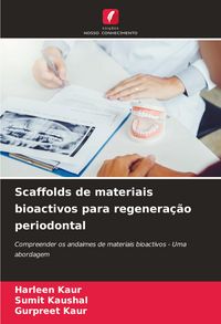 Produktbild: Scaffolds de materiais bioactivos para regenera&ccedil;&atilde;o periodontal