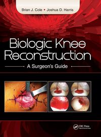 Produktbild: Biologic Knee Reconstruction