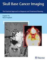 Produktbild: Skull Base Cancer Imaging