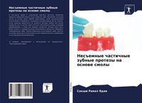 Produktbild: Nes#emnye chastichnye zubnye protezy na osnowe smoly