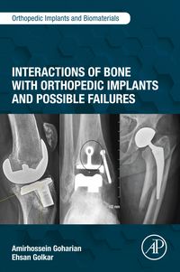 Produktbild: Interactions of Bone with Orthopedic Implants and Possible Failures