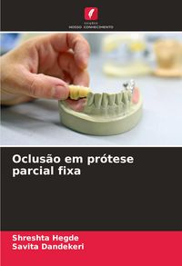 Produktbild: Oclus&atilde;o em pr&oacute;tese parcial fixa
