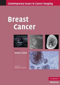 Produktbild: Breast Cancer
