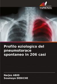 Produktbild: Profilo eziologico del pneumotorace spontaneo in 206 casi