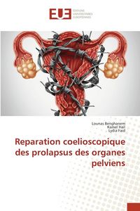 Produktbild: Reparation coelioscopique des prolapsus des organes pelviens