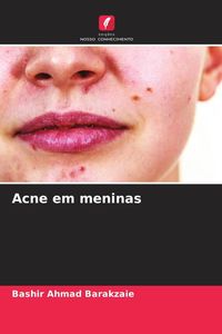 Produktbild: Acne em meninas