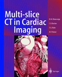 Produktbild: Multi-slice CT in Cardiac Imaging