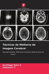 Produktbild: T&eacute;cnicas de Melhoria da Imagem Cerebral