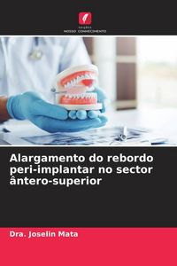 Produktbild: Alargamento do rebordo peri-implantar no sector &acirc;ntero-superior