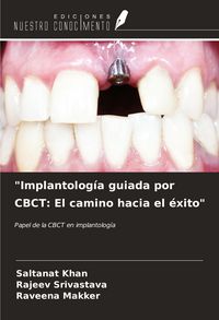 Produktbild: "Implantolog&iacute;a guiada por CBCT: El camino hacia el &eacute;xito"