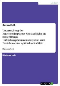 Produktbild: Untersuchung der Knochen/Implantat-Kontaktfl&auml;che im zementfreien H&uuml;ftgelenkpfannenersatzsystem zum Erreichen einer optimalen Stabilit&auml;t