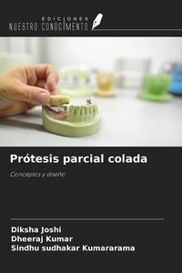 Produktbild: Pr&oacute;tesis parcial colada